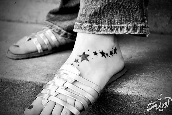 ازبین بردن تتو